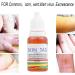 Mole Remover | 25g Beauty Care Liquid Mole Removal Solution For Women At Home While Traveling Daily Routine Care - Buy Online on GoSupps.com