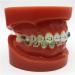ERNZI Typodont Teeth Model | Dental Orthodontic Demonstration for Science Teaching | International Shipping Available - Buy Online on GoSupps.com