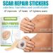 Silicone Scar Gel Strip - Efficient Scar Treatment for Surgery, Acne & Trauma - 4 * 150cm - Buy Online on GoSupps.com