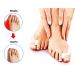 Hallux Valgus Corrector - Gel Medical Silicone - Anti-Chafing Pain Relief Separator - 6 Beige Pieces - Best Gift Idea - Buy Online on GoSupps.com