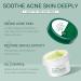 Anti Acne Treatment Acne Cream For Face Spot Cream For Acne Spot Treatment Tea Tree Face Cream for Spot Treatment for Acne Cream Moisturiser for Women Men Dilute Face Prone Spot Marks Cream 20G - Buy Online on GoSupps.com