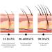 Dafeila Follicleboost Lot de 5 s rums de croissance des cheveux Follicle Boost pour la croissance des cheveux Croissance des cheveux en 2 6 semaines doux sur le cuir chevelu support plus fort 2 pi ces. - Buy Online on GoSupps.com
