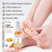 Foot Peeling Spray | Quick Callus Removal & Skin Care | Corneal Remover for Soft Feet - Buy Online on GoSupps.com