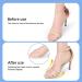 Yaopeing Metatarsal Pads 3-Pair Set | Non-Slip Ball of Foot Cushions for Women | Soft Gel Heel Insole Pads | Open Toe Shoe Comfort - Buy Online on GoSupps.com