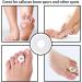 30 Round Felt Callus Pads | Metatarsal & Forefoot Cushions for Pain Relief | Adhesive Foot Pads for Men & Women - Buy Online on GoSupps.com