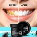 Naturals Activated Charcoal Teeth Whitening Powder - for Teeth Whitening Stain Remover Freshens Breath - with Activated Charcoal Turmeric & Clove Powder - 35g (Fluoride Free) - Buy Online on GoSupps.com