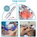 5 Pin Lancing Device Blood Lancet Pen + 200pcs Lancet - Steril Cupping Therapy Set - Buy Online on GoSupps.com
