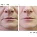 Vitali-Chi - Anti Aging Face Cream with Vitamins A E C & Pro-Vitamin B5 | for Moisturised Anti Wrinkle & Glowing skin - 50ml - Buy Online on GoSupps.com