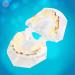 Buy Demonstration Orthodontic Oral Care Kits - Study Tools with Metal Bracket for Effective Teaching | International Shipping Available - Buy Online on GoSupps.com