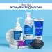 1% Salicylic Acid Gel Face Wash for Acne - Deep Cleansing & Exfoliating Formula | Reduces Acne & Controls Oil | 3.38 Fl Oz - Buy Online on GoSupps.com