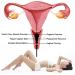 16 Species Yoni Jade Eggs - Natural Crystal Pelvic Floor Training & Massage for Women - Buy Online on GoSupps.com