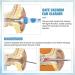 Smart Spiral Earwax Removal Kit for Kids and Adults - Blue-White - Buy Online on GoSupps.com