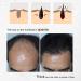 Organic Hair Growth Spray with Onion Oil, Rosemary & Black Seed - Control Hair Loss and Promote Healthy Hair Growth - Buy Online on GoSupps.com