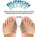 Orthopedic Bunion Toe Corrector - Gel Pad Pain Relief for Metatarsal & Hammer Toes | Unisex Insert Cushion Splint (2 Pack) - Buy Online on GoSupps.com