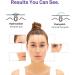 ACOTYE Spot Patches 32pcs with Tea Tree Oil and Salicylic Acid - Large Hydrocolloid Pimple Patches for Chin, Cheeks, Back - Niacinamide Infused (M 32) - Buy Online on GoSupps.com