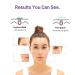 Acotye Pimple Patches - 32 Powerful Large Tea Tree Oil & Salicylic Acid Acne Treatments for Quick Healing of Breakouts on Chin Cheeks & Back - Buy Online on GoSupps.com
