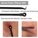Duduer Blackhead Remover Pimple Popper Tool Kit for Acne Extraction on Nose and Face - Professional Comedone Extractor for Whitehead Removal - Buy Online on GoSupps.com