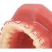 Orthodontic Tooth Model for Teaching - Metal Wires & Holder | Best Simulation for Learning - Buy Online on GoSupps.com