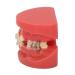 Orthodontic Model Orthodontic Demonstration Model 24 Teeth Metal Wire Case for Dental Hospital for