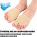 Bunion Corrector for Men & Women - Big Toe Straightener Socks | Hallux Valgus Cushion Guards & Support Brace (M Code 39-40) - Shop Internationally! - Buy Online on GoSupps.com