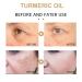 2 Pack Turmeric Dark Spot Corrector Serum - Natural Face Serum for Dark Spots Moisturizing & Repair (30ml) | Best Skin Care Solution - Buy Online on GoSupps.com