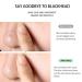 Yuhaever Blackhead Remover Pore Vacuum Kit - Rechargeable, Strong Suction, 4 Probes for Nose & Skin, Face Scrubber - 3 Models - Buy Online on GoSupps.com