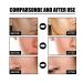 2pcs Nourishing Face Serum Shrinking Pores Brightening Skin Rejuvenation Eye Bags Removing Dark Circles Moisturizing Facial Essence - Buy Online on GoSupps.com