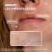 Mixa - Anti-Imperfections Concentrated Serum - For blemish-prone skin - Enriched with Salicylic Acid and Niacinamide - 30 ml - Buy Online on GoSupps.com