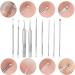 9 in 1 Pimple Blackhead Remover Extractor Tool Kit Professional Blackhead Remover Comedone Pimple Extractor Tool with a Leather Bag - Buy Online on GoSupps.com
