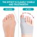 Hallux Valgus Socks Hallux Valgus Corrector Hallux Valgus Toe Separator Corrector Splint with Gel Pad Elastic and Soft Ba - Buy Online on GoSupps.com