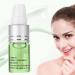 Mole Removal Cream Pigment Repair Gel Melanin Spot Corrector Cream Crea for Skin Brightening & Pigment Removal Dark Spot Recovery Solution - Buy Online on GoSupps.com