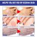 Mandurs South Moon Psoriasis Repair Spray - Herbal Treatment for Skin with Youth Bee Venom Cream (1pcs) - Buy Online on GoSupps.com