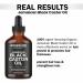 Jamaican Black Castor Oil - Pure Cold Pressed for Hair Growth Eyelash & Eyebrow Care Body Massage & Nail Moisturizing - Organic International Shipping - Buy Online on GoSupps.com
