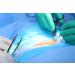 Dukal Single Use Suture Removal Kit - Sterile Trays with Scissors, Forceps, and Gauze Pad for Disposable Use - Buy Online on GoSupps.com