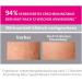 Merz Special Stretch Strip Intensive Cream - Reduce Stretch Marks & Improve Skin Appearance - 75ml - Buy Online on GoSupps.com