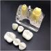Teeth lesson model - 4 times enlarged teeth planting explanation model - simulation oral dental teeth demonstration model - implant nail nail removable crown - for lesson lessons a