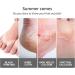 Foot Peel Mask 2 Pairs milk Exfoliating Foot Mask Peel For Dead Skin mild Formula Moisturising Brightening Socks Callus Remover Foot Mask Baby Soft Smooth Touch Feet - Buy Online on GoSupps.com