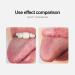 Monnadu Stainless Steel Tongue Scraper - Professional Tongue Cleaner for Fresher Breath | Rose Gold Metal Tongue Scraps to Reduce Bad Breath | Perfect for Adults - Buy Online on GoSupps.com
