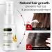 Hair Growth Serum Spray Hair Growth Accelerator Wild Growth Hair Ginger Oil for Hair Loss Treatments 20ML hair growth accelerator - Buy Online on GoSupps.com