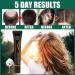 Hocossy Regrowth Organic Hair Serum Roller Set - Scalp Intense Hair Growth Treatment for Men & Women 20ml 3PCs - Natural Hair Care Solution - Buy Online on GoSupps.com