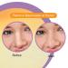 Generic Nose Pore Strips | Deep Cleansing & Painless Blackhead Removal | 10 PCS with Vitamin C | International Shipping Available - Buy Online on GoSupps.com