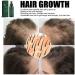S Rum De Croissance Des Cheveux Au Ginseng En Spray Pour Hommes Et Femmes S Rum De Repousse Des Cheveux Au Gingembre Pour La Perte De Cheveux L' Claircissement Des Cheveux (3pcs) - Buy Online on GoSupps.com