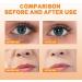 Dajidafu Portable Eye Dark Circle Spray Anti-age Anti-wrinkle Mist Sprays Moisturizing Hydrating Sprayer Wrinkle Remover Skin Care - Buy Online on GoSupps.com