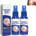 BIVOO Psoriasis Repair Spray Herbal Psoriasis Treatment Spray for Skin Plaque Psoriasis Herbal Psoriasis Treatment Spray (Size : 2pcs)