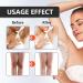 Snow Bleach Private Area Lightening Cream Body Bleaching Cream Snow Bleach Cream For Private Area Lightening And Anti-Black Cream For Skin Dark Remover For Dark Skin (1pc) - Buy Online on GoSupps.com