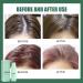 Hair Spray Quick Volume Long Lasting Refreshing -Free Air and Fluffy Fluffy Volumizing Oil-Control Volume Lift (3PCS) - Buy Online on GoSupps.com