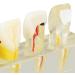 Endodontic Model - Stable Portable Dental Pulp Model for Practice & Teaching | International Shipping - Buy Online on GoSupps.com