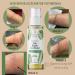 Brittanie's Thyme Skin Repair Accelerator for Scars & Stretchmarks | Natural Non-Toxic Treatment, Dermatologist Recommended for Deep Nourishment, Wrinkle Reduction, and Itchy Skin - Ideal for Damaged Skin & Tattoos - Buy Online on GoSupps.com