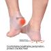 Silicone Gel Heel Socks for Plantar Fasciitis Relief and Skin Care - 2 Pairs - Buy Online on GoSupps.com