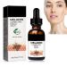 Melanin Correcting Facial Serum 30ml 2023 New Dark Spot Corrector Remover Skin Care Moisturizing Repair Serum Hyaluronic Acid Vitamin C Serum for Face (1pcs)